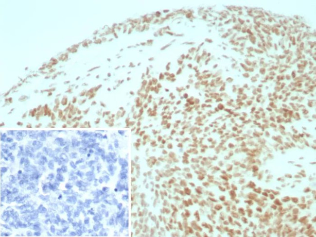 Integrase interactor 1 (INI-1)/SNF5/SMARCB1 Antibody in Immunohistochemistry (Paraffin) (IHC (P))