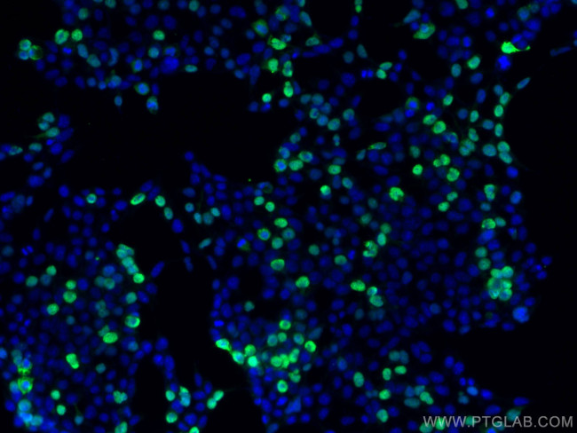 DYKDDDDK tag Antibody in Immunocytochemistry (ICC/IF)