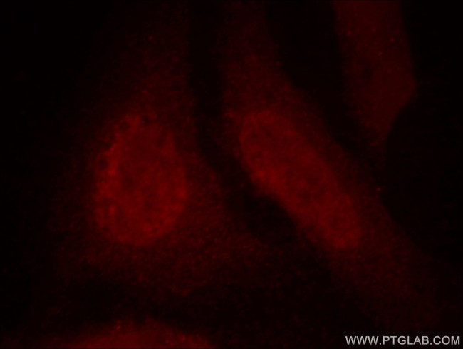DDB1 Antibody in Immunocytochemistry (ICC/IF)