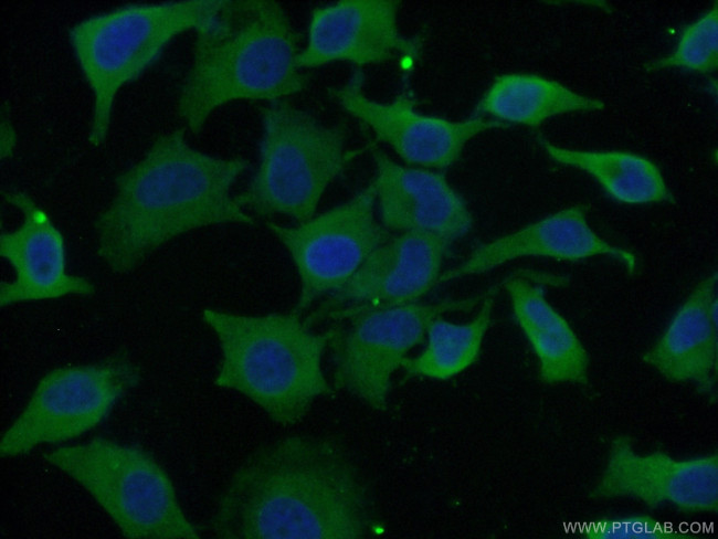 EIF3D Antibody in Immunocytochemistry (ICC/IF)