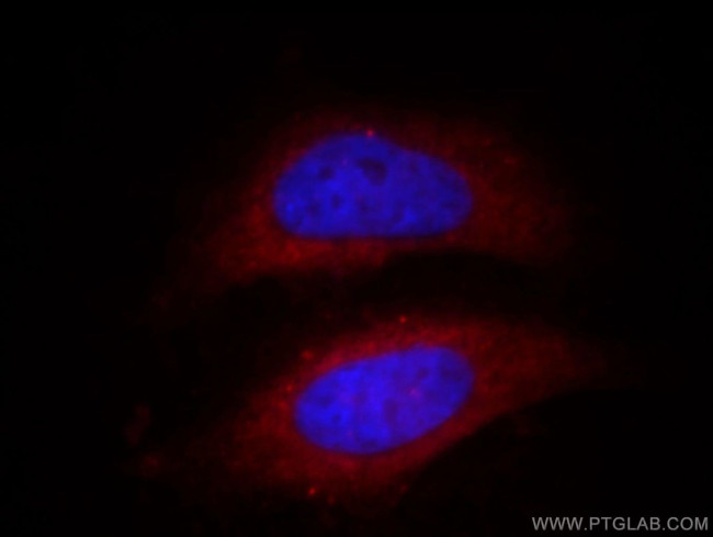 IVD Antibody in Immunocytochemistry (ICC/IF)