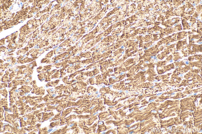 CPT1A Antibody in Immunohistochemistry (Paraffin) (IHC (P))
