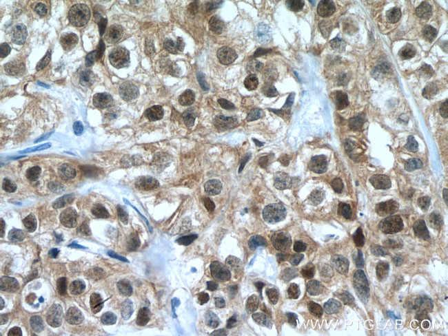 FKBP52 Antibody in Immunohistochemistry (Paraffin) (IHC (P))