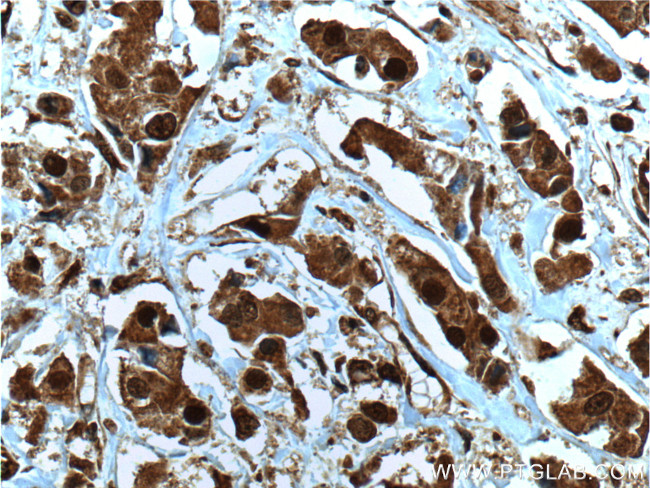 NOB1 Antibody in Immunohistochemistry (Paraffin) (IHC (P))