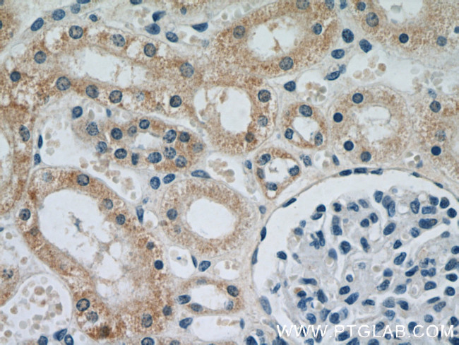 NDUFS5 Antibody in Immunohistochemistry (Paraffin) (IHC (P))