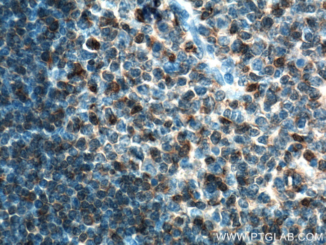 ARHGDIB Antibody in Immunohistochemistry (Paraffin) (IHC (P))
