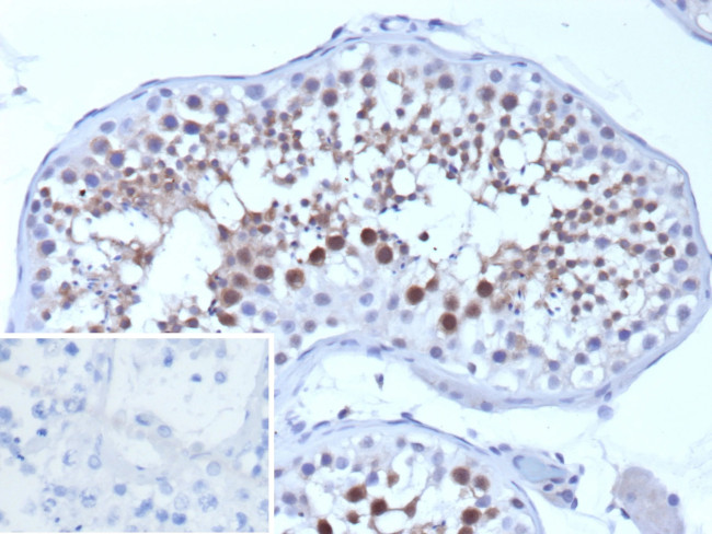 Survival of motor neuron 1, telomeric (SMN1 )/Gemin 1 Antibody in Immunohistochemistry (Paraffin) (IHC (P))