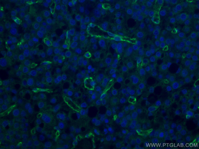 CD31 Monoclonal Antibody (3F8E2) | Invitrogen (66065-2-IG)