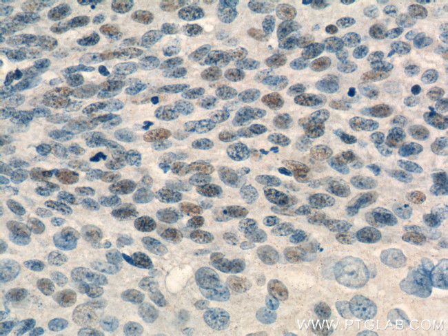 USP1 Antibody in Immunohistochemistry (Paraffin) (IHC (P))