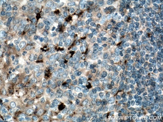 alpha 1 Antichymotrypsin Antibody in Immunohistochemistry (Paraffin) (IHC (P))