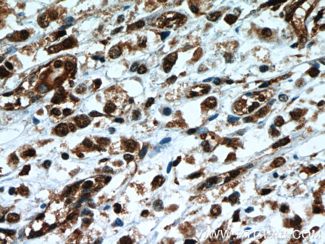 TLE3 Antibody in Immunohistochemistry (Paraffin) (IHC (P))