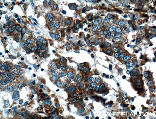 FKBP2 Antibody in Immunohistochemistry (Paraffin) (IHC (P))