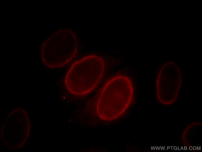 S100A6 Antibody in Immunocytochemistry (ICC/IF)