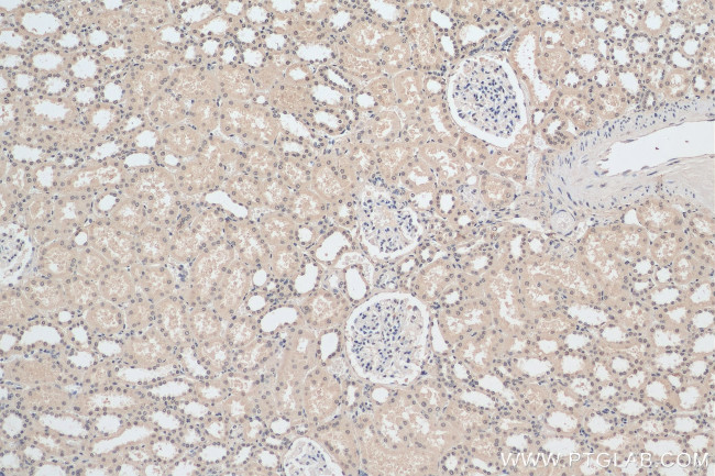 MBIP Antibody in Immunohistochemistry (Paraffin) (IHC (P))