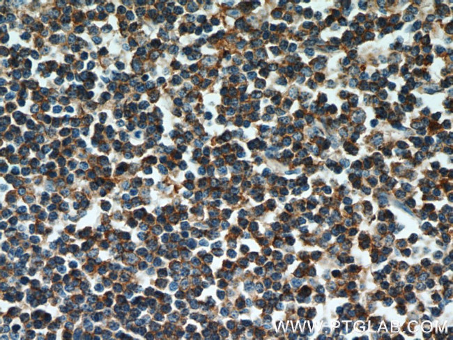 CD22 Antibody in Immunohistochemistry (Paraffin) (IHC (P))