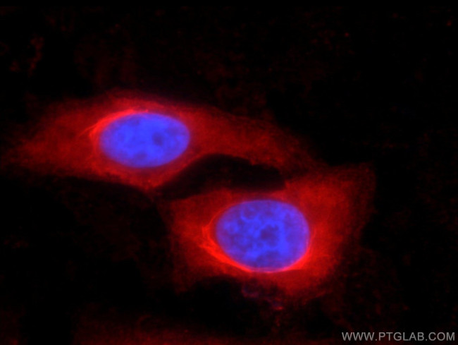 Iduronate 2 sulfatase Antibody in Immunocytochemistry (ICC/IF)