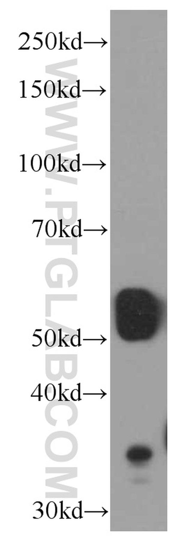 SMARCD1 Antibody in Western Blot (WB)