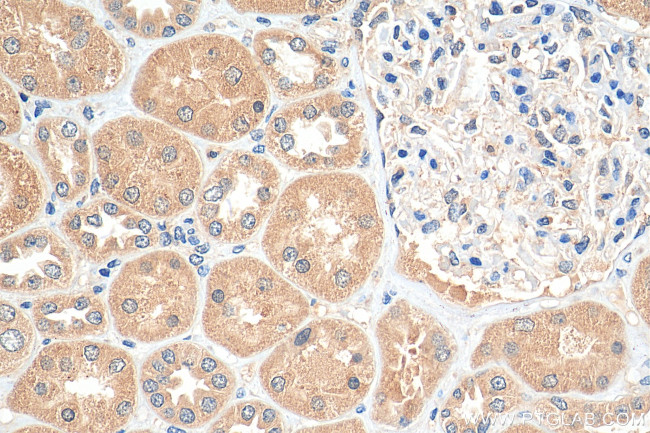 TRAPPC9/NIBP Antibody in Immunohistochemistry (Paraffin) (IHC (P))