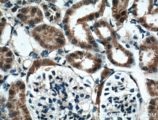 BBS5 Antibody in Immunohistochemistry (Paraffin) (IHC (P))