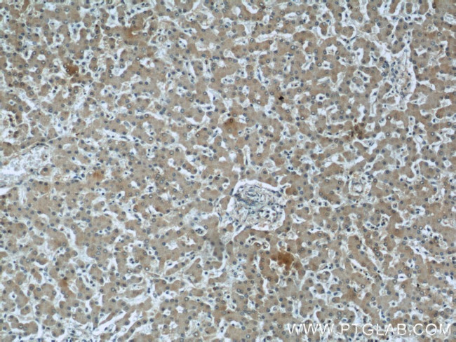 TRPC4AP Antibody in Immunohistochemistry (Paraffin) (IHC (P))