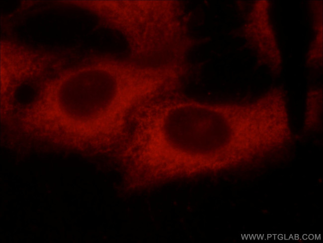 C9orf72 Antibody in Immunocytochemistry (ICC/IF)