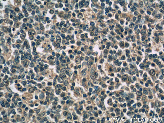 IL9 Antibody in Immunohistochemistry (Paraffin) (IHC (P))