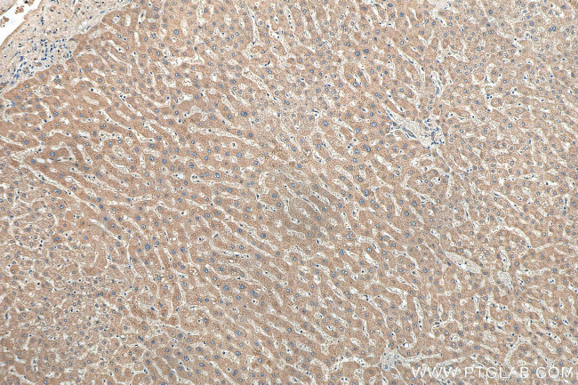 TIMM44 Antibody in Immunohistochemistry (Paraffin) (IHC (P))