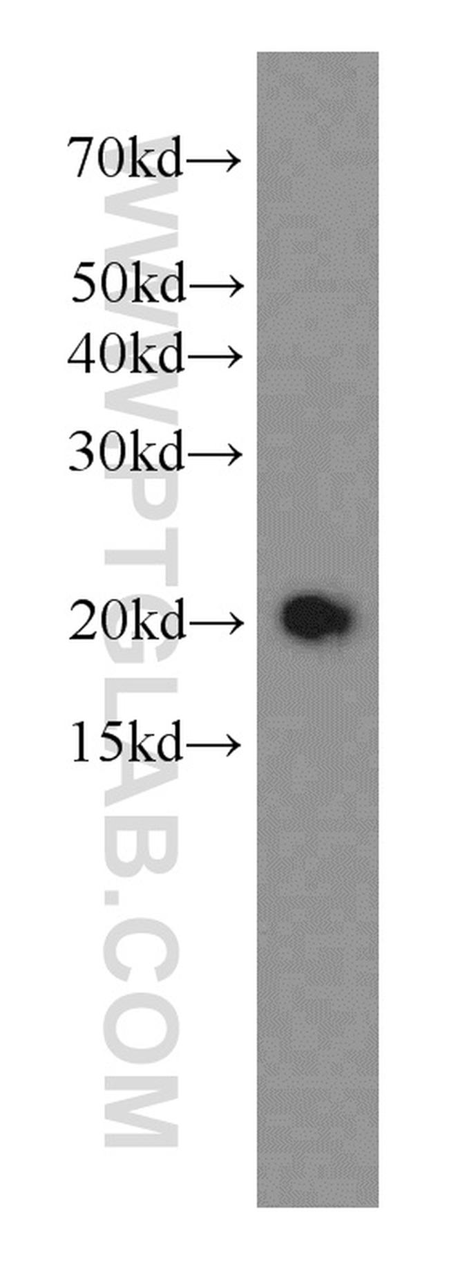 STMN3 Antibody in Western Blot (WB)