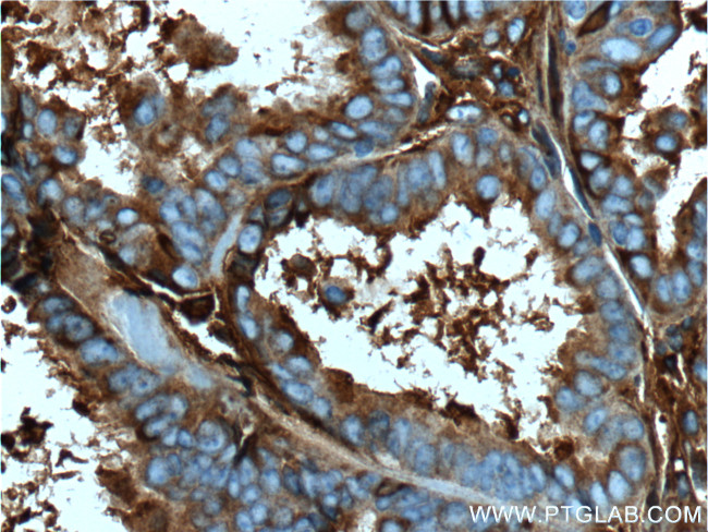 Ceruloplasmin Antibody in Immunohistochemistry (Paraffin) (IHC (P))
