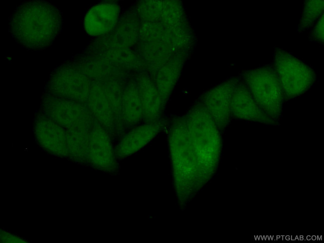 MSH6 Antibody in Immunocytochemistry (ICC/IF)