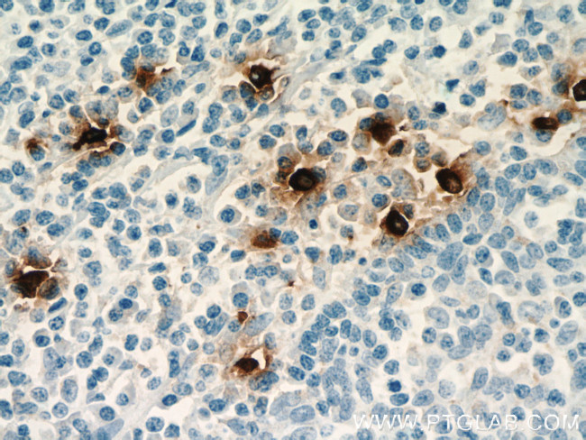 TPSAB1 Antibody in Immunohistochemistry (Paraffin) (IHC (P))