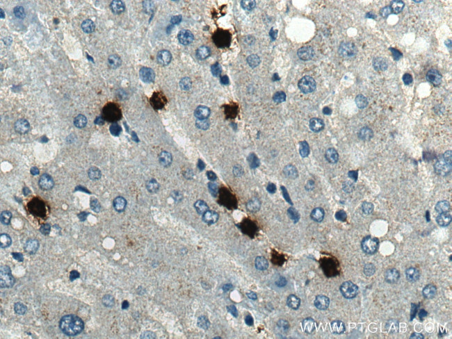 MPO Antibody in Immunohistochemistry (Paraffin) (IHC (P))