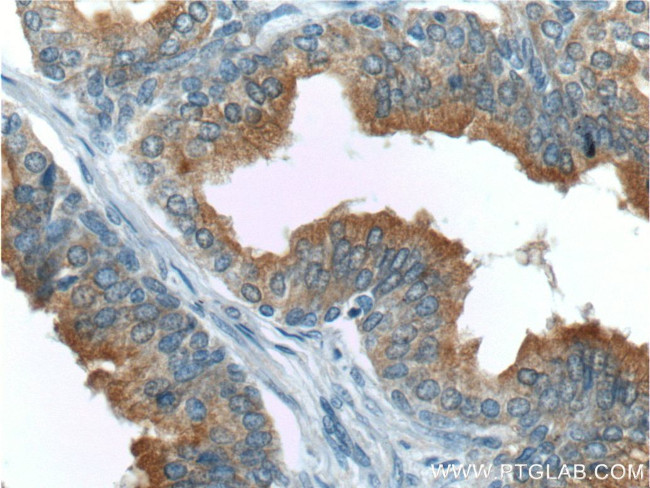 Zinc-alpha-2-glycoprotein Antibody in Immunohistochemistry (Paraffin) (IHC (P))