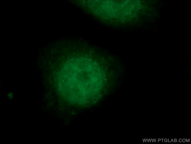 SMARCE1 Antibody in Immunocytochemistry (ICC/IF)