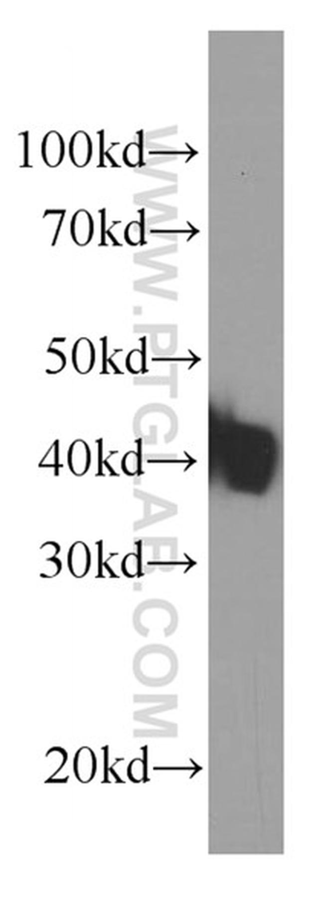KLF15 Antibody in Western Blot (WB)