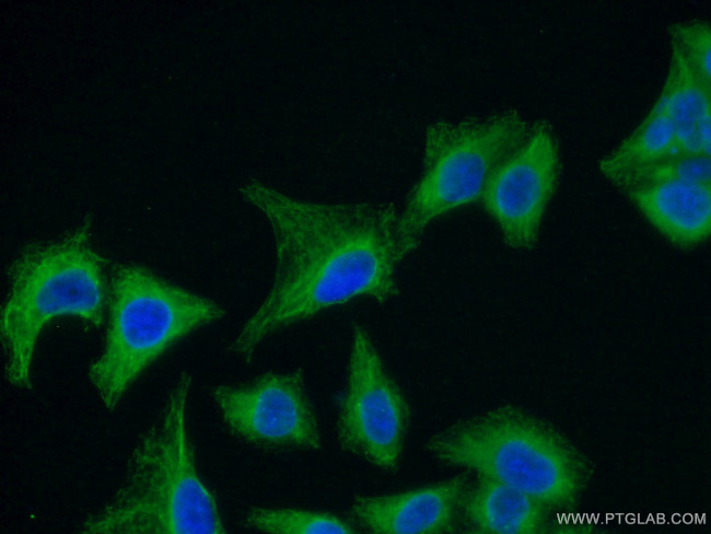SEPT8 Antibody in Immunocytochemistry (ICC/IF)