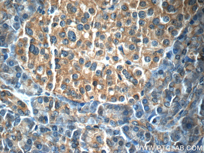 IL23A Antibody in Immunohistochemistry (Paraffin) (IHC (P))