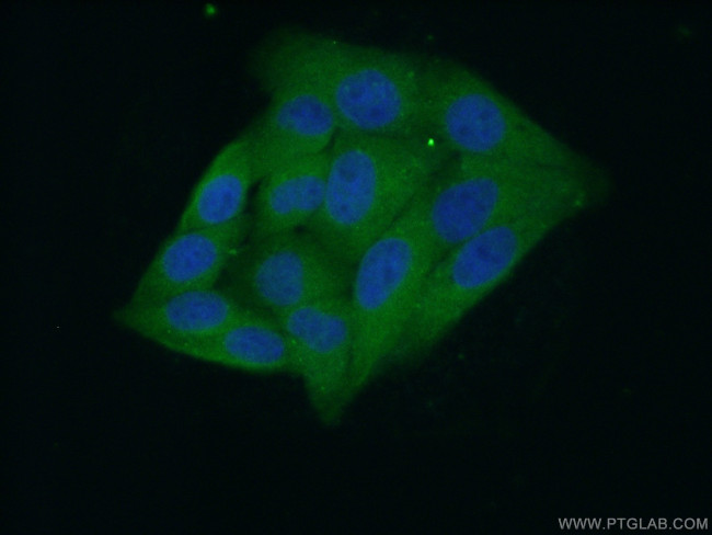 IDH1 Antibody in Immunocytochemistry (ICC/IF)