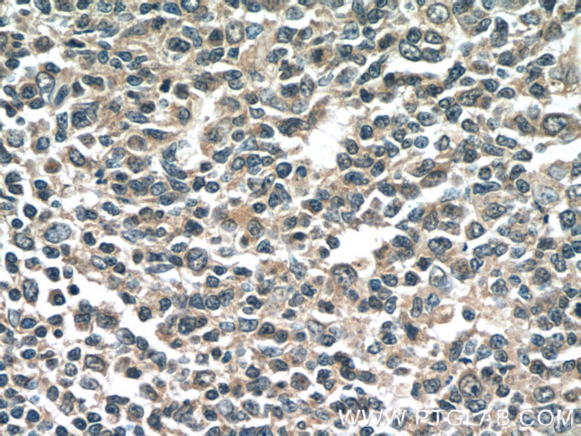 NINJ2 Antibody in Immunohistochemistry (Paraffin) (IHC (P))