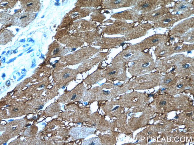 Myoglobin Antibody in Immunohistochemistry (Paraffin) (IHC (P))