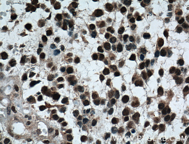 TLE1 Antibody in Immunohistochemistry (Paraffin) (IHC (P))