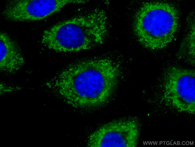 S100A10 Antibody in Immunocytochemistry (ICC/IF)