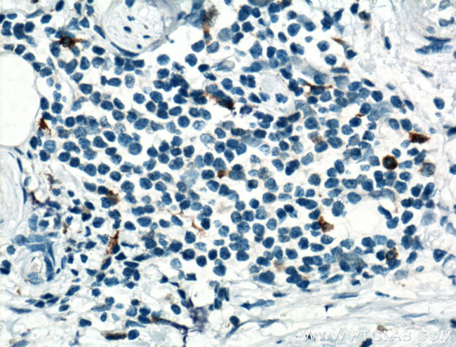 CD68 Antibody in Immunohistochemistry (Paraffin) (IHC (P))