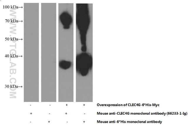 CLEC4G Antibody in Western Blot (WB)