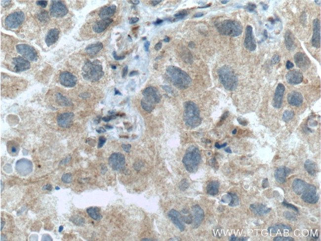 p38 MAPK Antibody in Immunohistochemistry (Paraffin) (IHC (P))