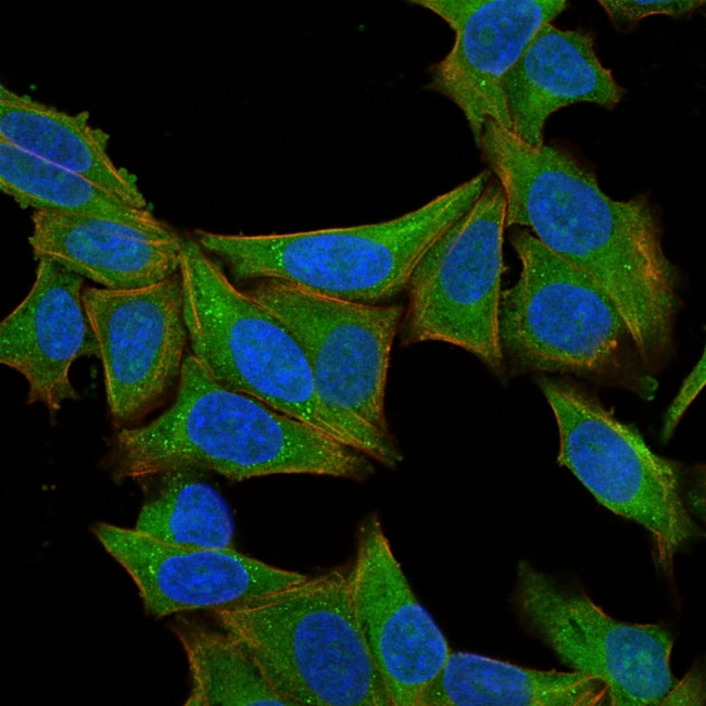Fascin-1 (Reed-Sternberg Cell Marker) Antibody in Immunocytochemistry (ICC/IF)