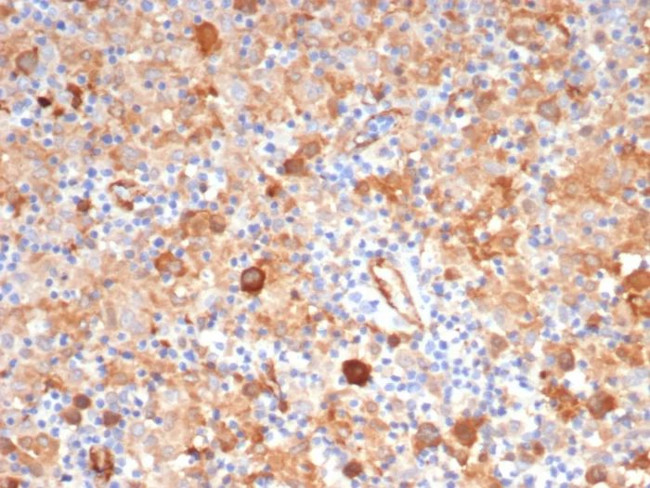 Fascin-1 (Reed-Sternberg Cell Marker) Antibody in Immunohistochemistry (Paraffin) (IHC (P))