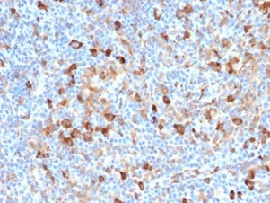 Fascin-1 (Reed-Sternberg Cell Marker) Antibody in Immunohistochemistry (Paraffin) (IHC (P))