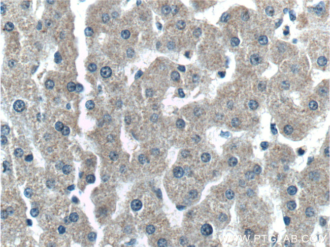 C4 gamma chain Antibody in Immunohistochemistry (Paraffin) (IHC (P))