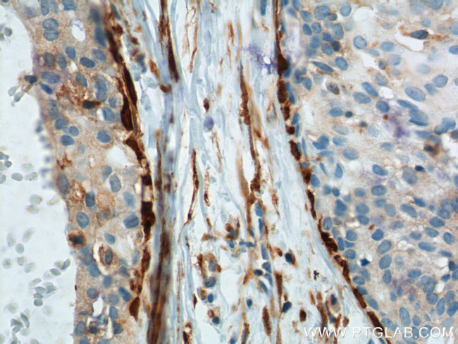 CNN2 Antibody in Immunohistochemistry (Paraffin) (IHC (P))